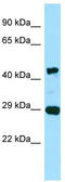 Actin Gamma 2, Smooth Muscle antibody, TA338267, Origene, Western Blot image 