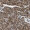 Toll Like Receptor Adaptor Molecule 2 antibody, NBP1-90949, Novus Biologicals, Immunohistochemistry frozen image 