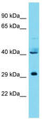 Integrator Complex Subunit 11 antibody, TA331879, Origene, Western Blot image 