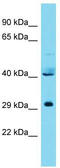 Integrator complex subunit 11 antibody, TA331879, Origene, Western Blot image 