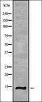 Eukaryotic Translation Initiation Factor 1B antibody, orb338303, Biorbyt, Western Blot image 