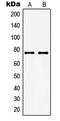 Guanylate Cyclase 1 Soluble Subunit Alpha 1 antibody, LS-C352289, Lifespan Biosciences, Western Blot image 