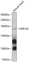 Adhesion G Protein-Coupled Receptor G6 antibody, 13-576, ProSci, Western Blot image 