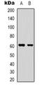 YTH N6-Methyladenosine RNA Binding Protein 1 antibody, orb318955, Biorbyt, Western Blot image 