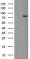 Peptidyl Arginine Deiminase 4 antibody, LS-C787267, Lifespan Biosciences, Western Blot image 