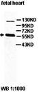 ADCYAP Receptor Type I antibody, orb77756, Biorbyt, Western Blot image 