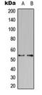 Potassium Voltage-Gated Channel Modifier Subfamily S Member 2 antibody, orb216137, Biorbyt, Western Blot image 