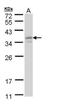 General Transcription Factor IIE Subunit 2 antibody, NBP1-32717, Novus Biologicals, Western Blot image 