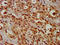 Carbamoyl-Phosphate Synthase 1 antibody, LS-C669845, Lifespan Biosciences, Immunohistochemistry paraffin image 