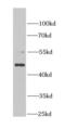 MDM2 Proto-Oncogene antibody, FNab05077, FineTest, Western Blot image 