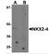 NK2 Homeobox 4 antibody, MBS150696, MyBioSource, Western Blot image 