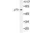 Tumor Protein P73 antibody, LS-C177003, Lifespan Biosciences, Western Blot image 