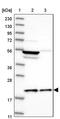 Mitochondrial Ribosomal Protein L18 antibody, PA5-55973, Invitrogen Antibodies, Western Blot image 