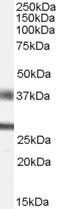 Fibroblast Growth Factor 23 antibody, LS-C54835, Lifespan Biosciences, Western Blot image 