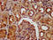 Kinesin Family Member 22 antibody, LS-C675139, Lifespan Biosciences, Immunohistochemistry paraffin image 