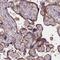 NLR Family Apoptosis Inhibitory Protein antibody, NBP1-88596, Novus Biologicals, Immunohistochemistry paraffin image 