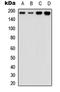 Erb-B2 Receptor Tyrosine Kinase 3 antibody, LS-C368595, Lifespan Biosciences, Western Blot image 
