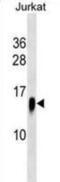 ATPase H+ Transporting V1 Subunit F antibody, abx030807, Abbexa, Western Blot image 