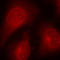 Histone Deacetylase 8 antibody, LS-C335998, Lifespan Biosciences, Immunofluorescence image 