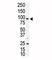 AXL Receptor Tyrosine Kinase antibody, F50552-0.4ML, NSJ Bioreagents, Western Blot image 