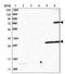 ATP Binding Cassette Subfamily G Member 1 antibody, NBP2-54682, Novus Biologicals, Western Blot image 