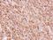 Tetratricopeptide Repeat Domain 30A antibody, LS-C185879, Lifespan Biosciences, Immunohistochemistry paraffin image 