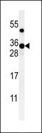 Zinc Finger CCHC-Type Containing 24 antibody, 61-681, ProSci, Western Blot image 