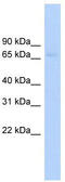 ATP Binding Cassette Subfamily F Member 2 antibody, TA332056, Origene, Western Blot image 