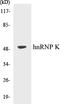 Heterogeneous Nuclear Ribonucleoprotein K antibody, EKC1280, Boster Biological Technology, Western Blot image 