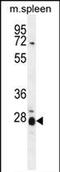 Interleukin-17B antibody, PA5-71616, Invitrogen Antibodies, Western Blot image 