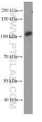 Protein Tyrosine Kinase 2 antibody, 66258-1-Ig, Proteintech Group, Western Blot image 