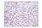 Lysine-specific demethylase 6A antibody, 33510S, Cell Signaling Technology, Immunohistochemistry paraffin image 