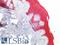 Keratin 10 antibody, LS-B16390, Lifespan Biosciences, Immunohistochemistry paraffin image 