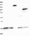 Solute Carrier Family 28 Member 3 antibody, NBP1-84417, Novus Biologicals, Western Blot image 