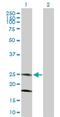 Potassium Calcium-Activated Channel Subfamily M Regulatory Beta Subunit 4 antibody, H00027345-B01P, Novus Biologicals, Western Blot image 