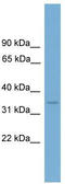 Lumican antibody, TA335062, Origene, Western Blot image 