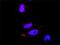 Ras Homolog Family Member A antibody, H00000387-M05, Novus Biologicals, Proximity Ligation Assay image 