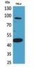 Inhibin Subunit Beta B antibody, A03838, Boster Biological Technology, Western Blot image 