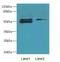 TRNA Methyltransferase 6 antibody, LS-C398242, Lifespan Biosciences, Western Blot image 