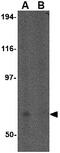 Formin Binding Protein 1 Like antibody, GTX85424, GeneTex, Western Blot image 