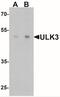 Unc-51 Like Kinase 3 antibody, NBP2-41243, Novus Biologicals, Western Blot image 