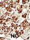 Plaucible mixed-lineage kinase antibody, 63-376, ProSci, Immunohistochemistry paraffin image 