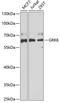 G Protein-Coupled Receptor Kinase 6 antibody, A6379, ABclonal Technology, Western Blot image 