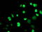 Myocyte Enhancer Factor 2C antibody, LS-C172812, Lifespan Biosciences, Immunofluorescence image 