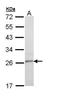 Tetraspanin 6 antibody, GTX111881, GeneTex, Western Blot image 