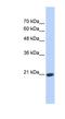 Transcription Elongation Factor A Like 8 antibody, NBP1-79349, Novus Biologicals, Western Blot image 