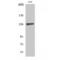 Paired amphipathic helix protein Sin3b antibody, LS-C384675, Lifespan Biosciences, Western Blot image 