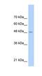 Toll Like Receptor 6 antibody, NBP1-54336, Novus Biologicals, Western Blot image 