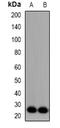 Fibroblast Growth Factor 11 antibody, orb382598, Biorbyt, Western Blot image 