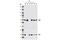 AKT Serine/Threonine Kinase 2 antibody, 3063P, Cell Signaling Technology, Western Blot image 